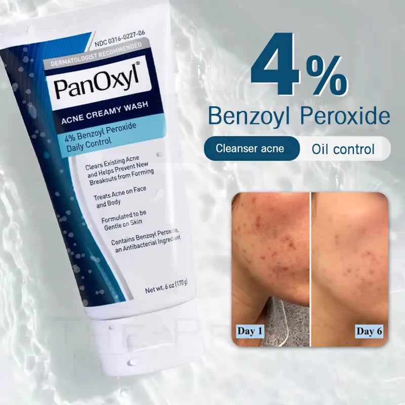 Panoxyl acne foaming wash benzoyl peroxide 4%