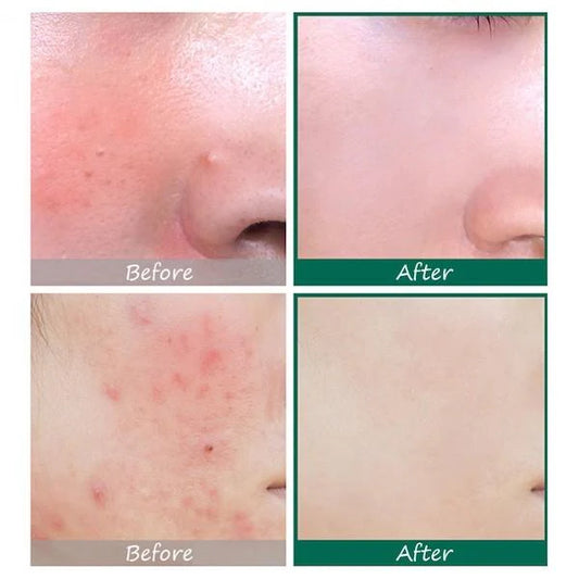 SOME BY MI AHA BHA PHA 30 Days Miracle Serum – Clear, Smooth & Balanced Skin