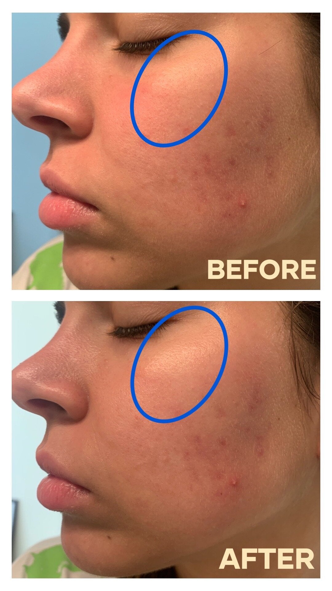 ESTEE LAUDER Advanced Night Repair Synchronized Multi Recovery Complex - Buynowpakistan