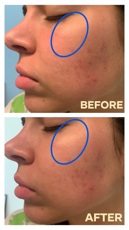 ESTEE LAUDER Advanced Night Repair Synchronized Multi Recovery Complex - Buynowpakistan